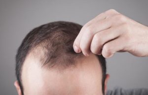 کاشت ابرو و کاشت مو در تعطیلات نوروز