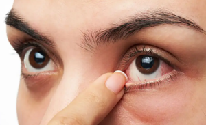 آیا جراحی پلک باعث خشک شدن چشم میشود؟