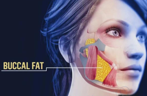 تفاوت بوکال فت در خانمها و آقایان