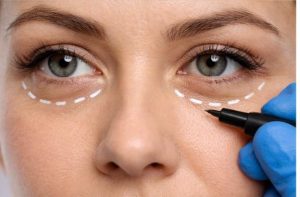 جراحی پف زیر چشم